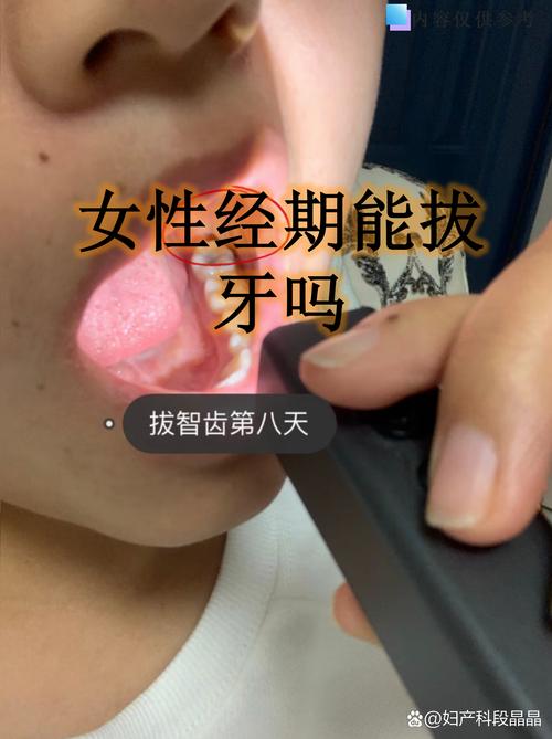 经期牙痛能拔牙吗