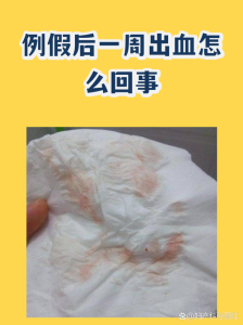 月经刚走没几天又出血是怎么回事?别慌,帮你捋一捋-两性知识丨两性健康--你想了解的我都知道