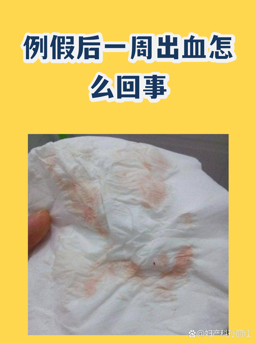 月经刚走又出血是什么原因