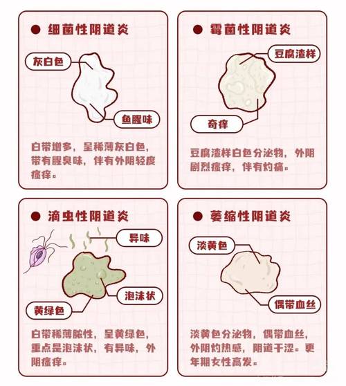 滴虫性阴道炎怎么治疗