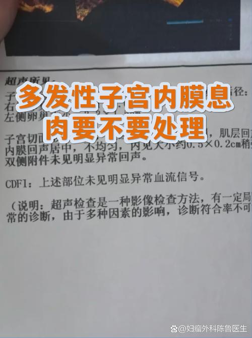 子宫内膜息肉要处理吗