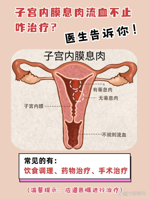 子宫内膜息肉要处理吗