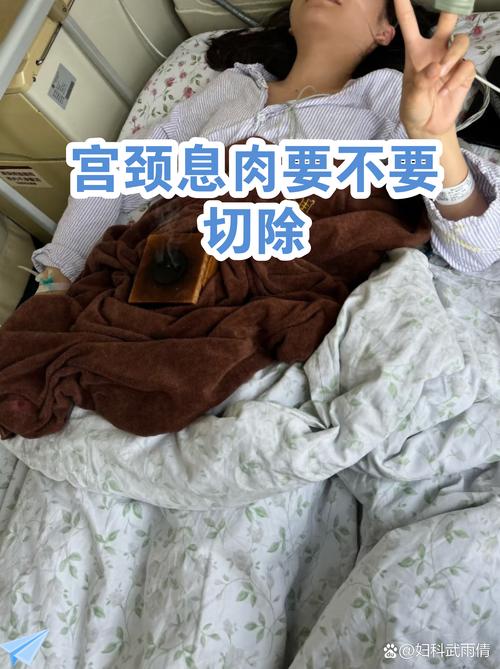 宫颈息肉需要手术切除吗