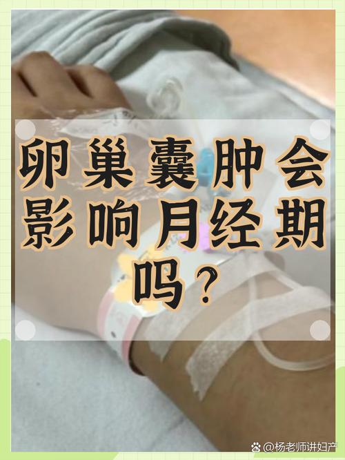 卵巢囊肿复查要避开月经期吗