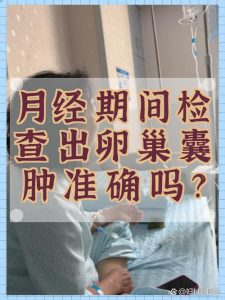 卵巢囊肿复查要避开月经期吗?-两性知识丨两性健康--你想了解的我都知道