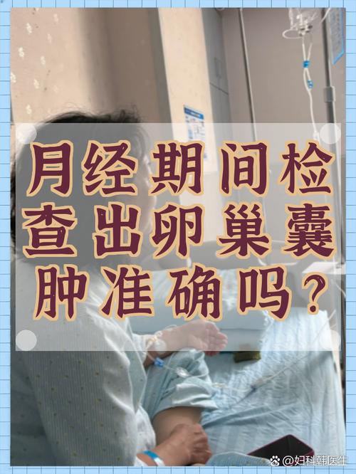 卵巢囊肿复查要避开月经期吗