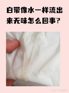 白带像水一样流出来正常吗?这几种情况心里要有数-两性知识丨两性健康--你想了解的我都知道