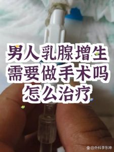 男性乳腺增生真的需要手术吗?先看清这几点-两性知识丨两性健康--你想了解的我都知道