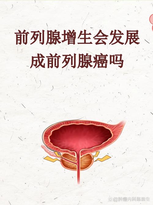 前列腺增生会变成癌吗