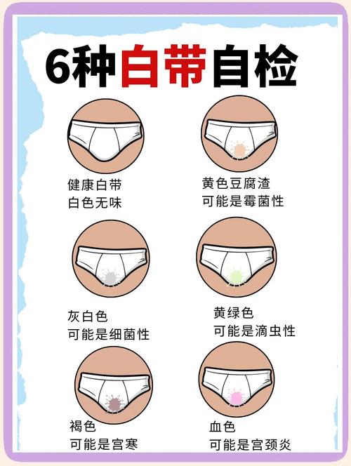 白带检查前一天要注意什么