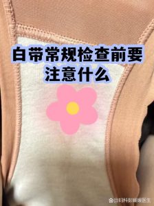 白带检查前一天要注意什么-两性知识丨两性健康--你想了解的我都知道