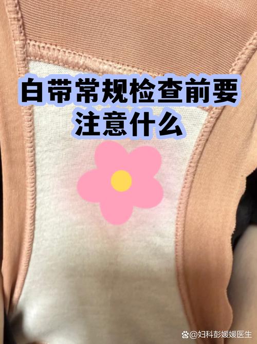 白带检查前一天要注意什么