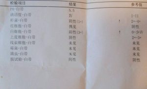 阴道分泌物培养能查出什么-两性知识丨两性健康--你想了解的我都知道