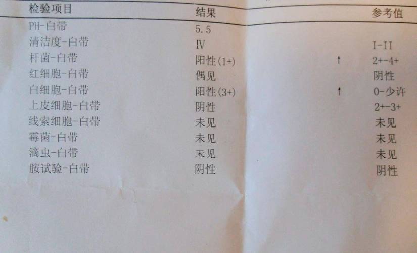 阴道分泌物培养能查出什么