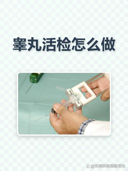 睾丸活检主要是查什么