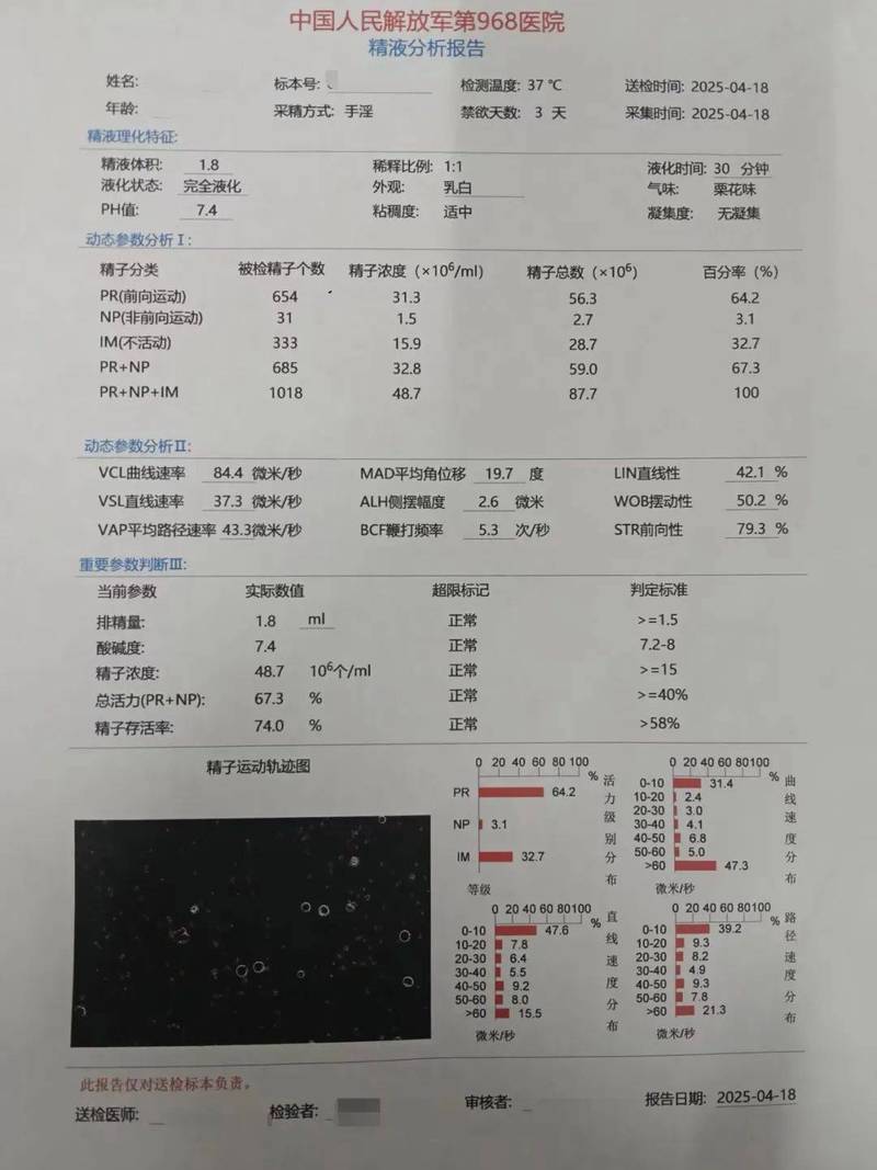 精液检查结果波动大正常吗
