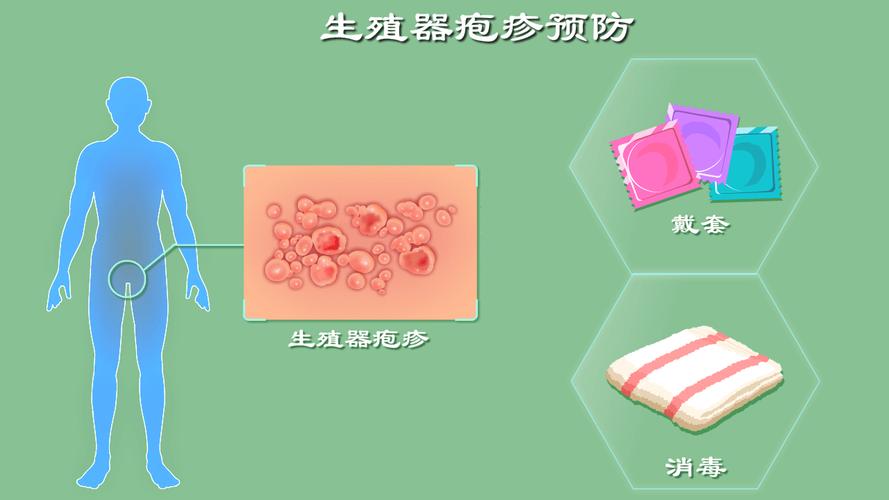生殖器疱疹会反复发作吗