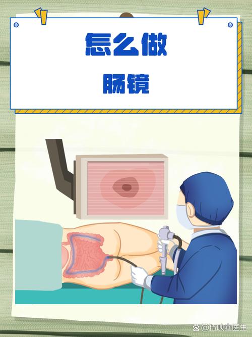 备孕期间能做肠镜检查吗