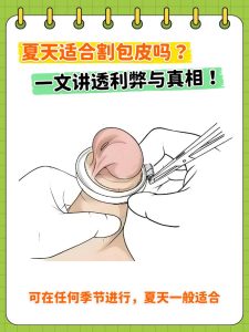 龟头敏感一定要做手术吗-两性知识丨两性健康--你想了解的我都知道