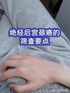 绝经后还需要做宫颈筛查吗-两性知识丨两性健康--你想了解的我都知道