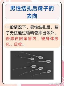男性结扎后精子去哪里了-两性知识丨两性健康--你想了解的我都知道