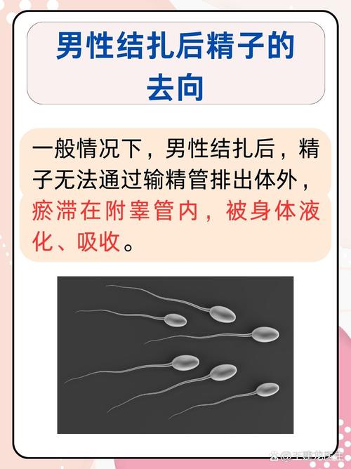 男性结扎后精子去哪里了