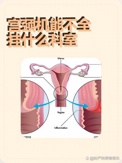 反复流产看生殖科还是妇产科