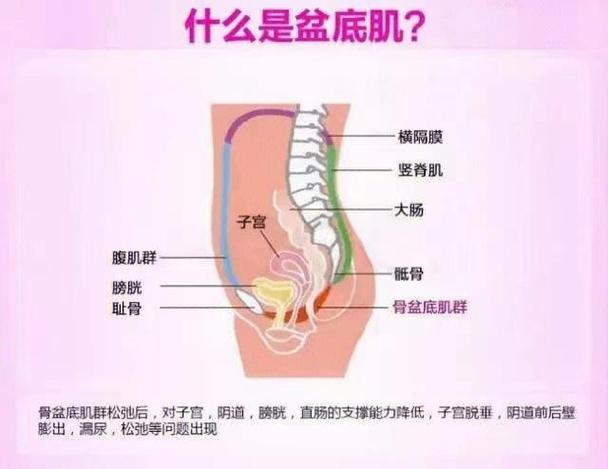 盆底康复有副作用吗