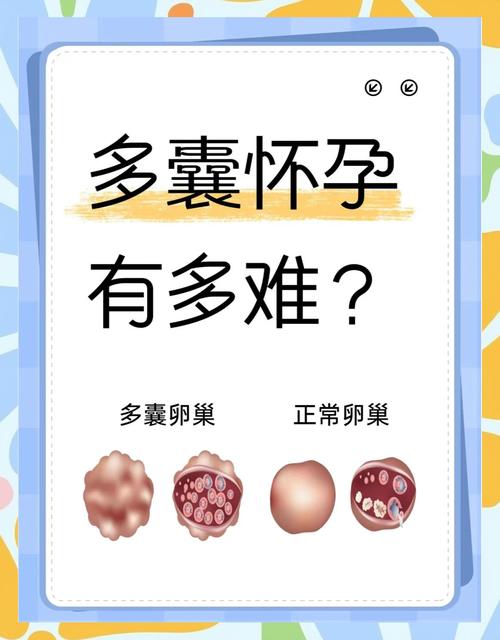 多囊患者能用避孕环调经吗
