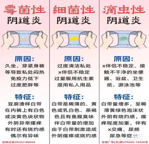 霉菌性阴道炎为什么总复发