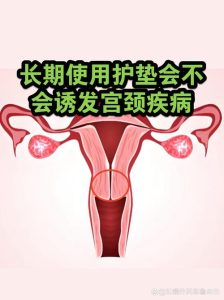 长期用护垫会导致不孕吗-两性知识丨两性健康--你想了解的我都知道