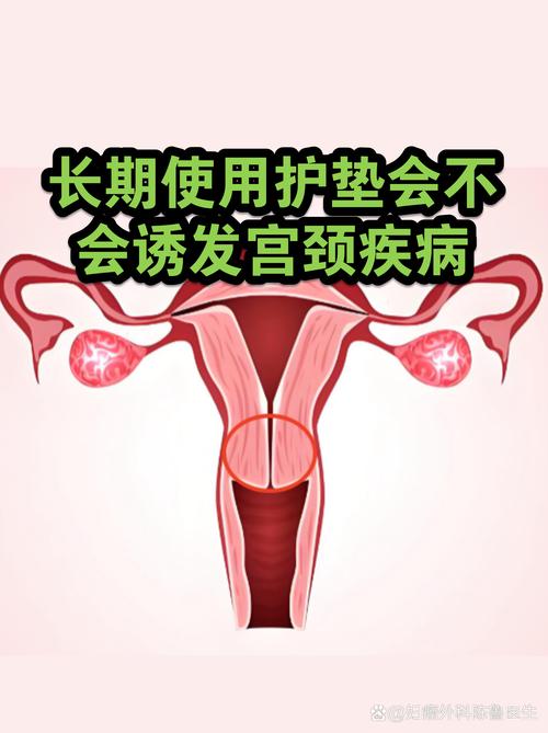 长期用护垫会导致不孕吗