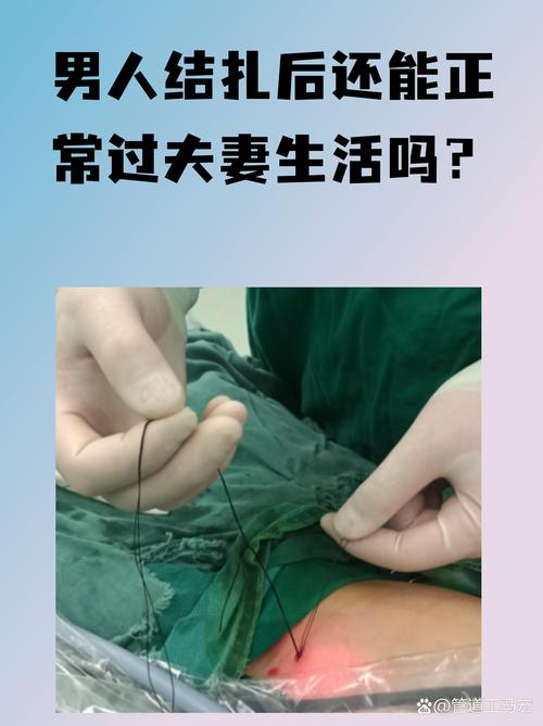 男性参与避孕的责任怎么界定