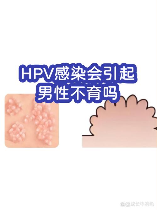 HPV感染会影响精子质量吗