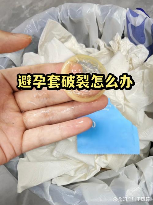 避孕套破了该怎么补救