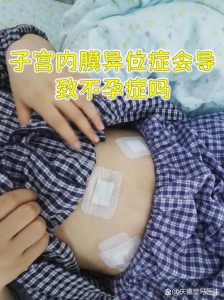 子宫内膜异位症真的会导致怀不上孩子吗？-两性知识丨两性健康--你想了解的我都知道