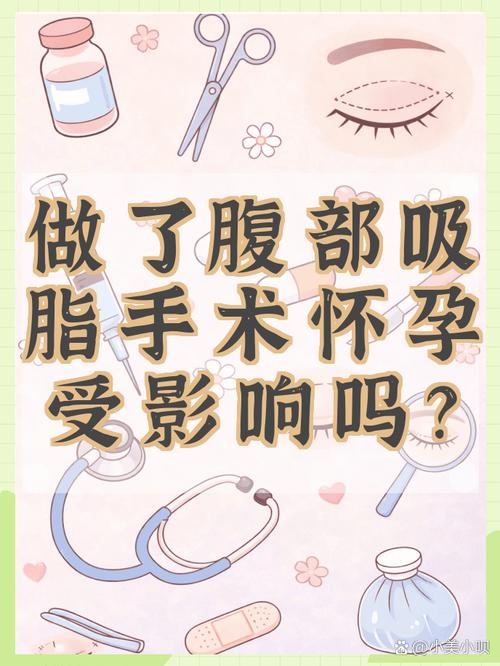 备孕期间能做吸脂手术吗