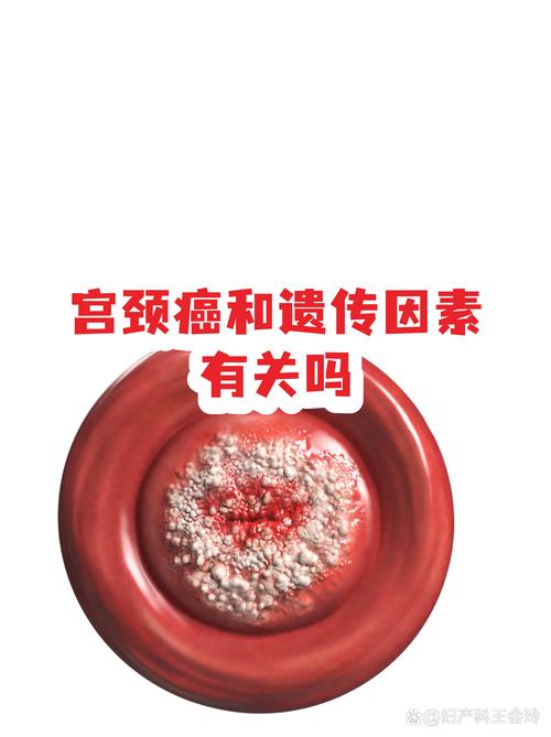 妇科癌症和遗传基因有关吗