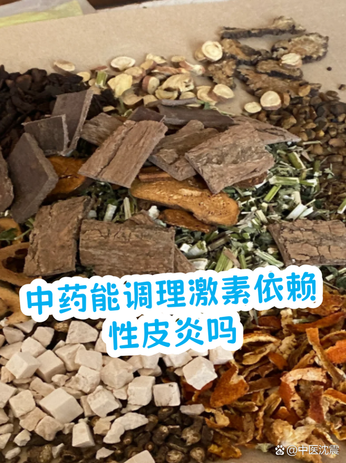 激素治疗期间能喝中药吗