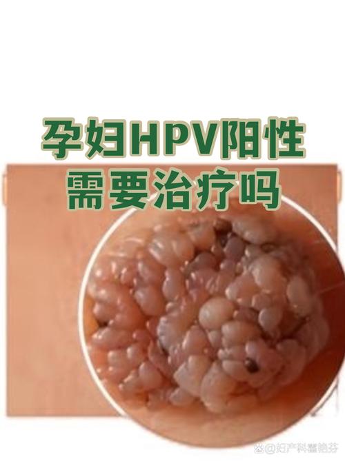 HPV阳性需要治疗吗
