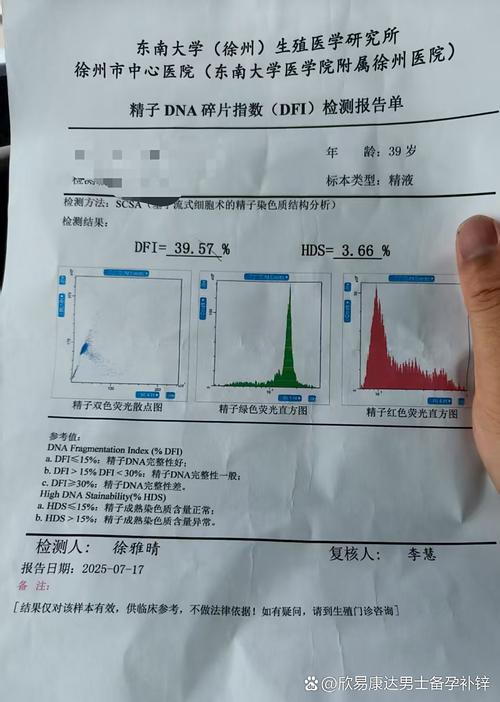 精子碎片率复查间隔多久合适