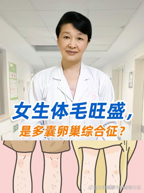 青春期女孩体毛多要看医生吗