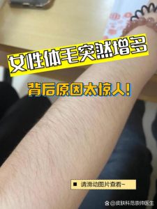 青春期女孩体毛多要看医生吗?-两性知识丨两性健康--你想了解的我都知道