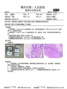 发现外阴有肿块,是不是一定要做活检才能放心?-两性知识丨两性健康--你想了解的我都知道