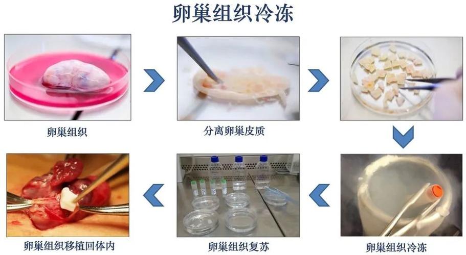 卵巢组织冻存要满足什么条件