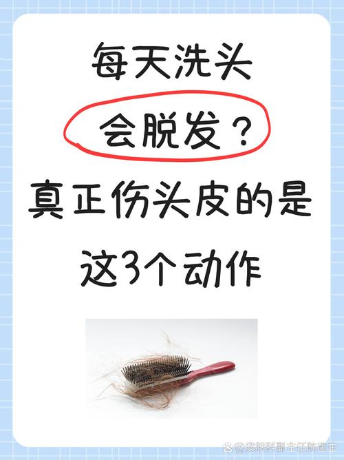天天洗头会导致脱发吗