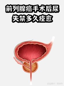 前列腺癌术后尿失禁能恢复吗?做好这几点,多数人能明显改善-两性知识丨两性健康--你想了解的我都知道