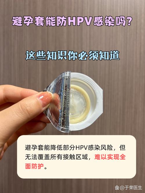 安全套能防住性传播感染吗