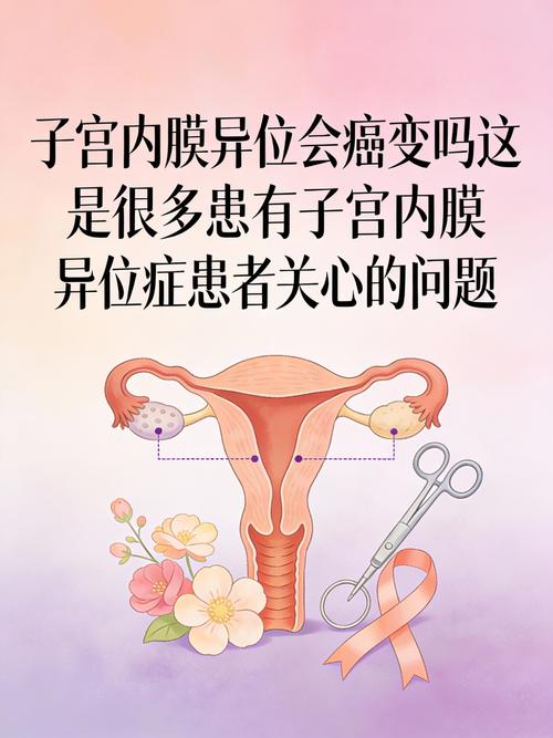 内异症会变成癌吗