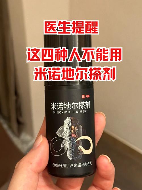 米诺地尔会降低性欲吗